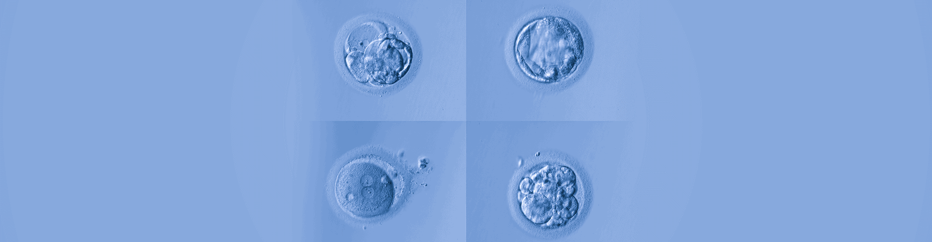 Calcium Ionophore Activation Calcium Ionophore IVF Felicity