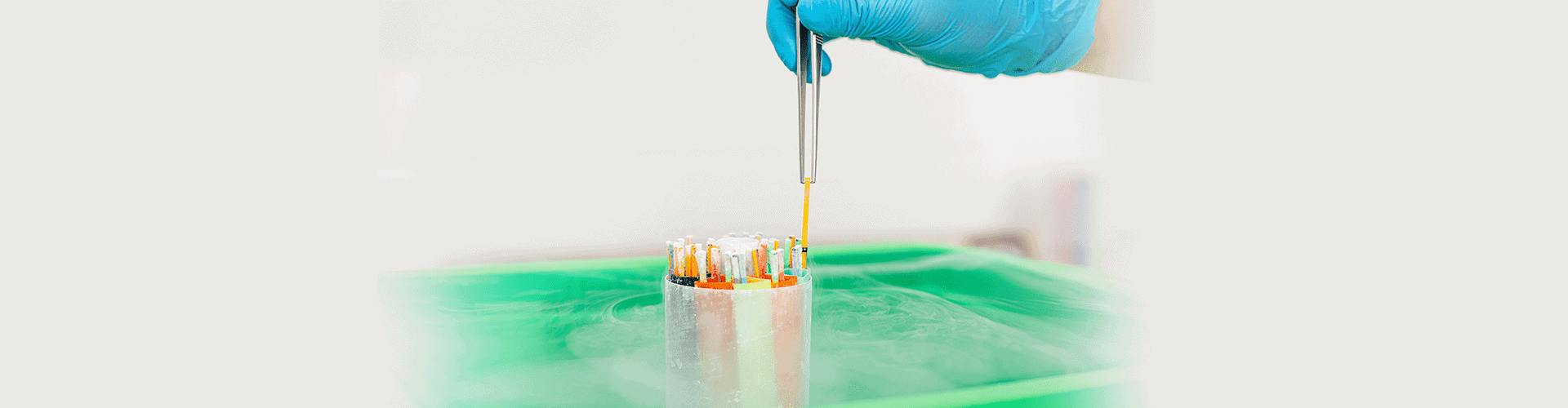 Embryo freezing Embryo Cryopreservation Embryo freezing cost Felicity