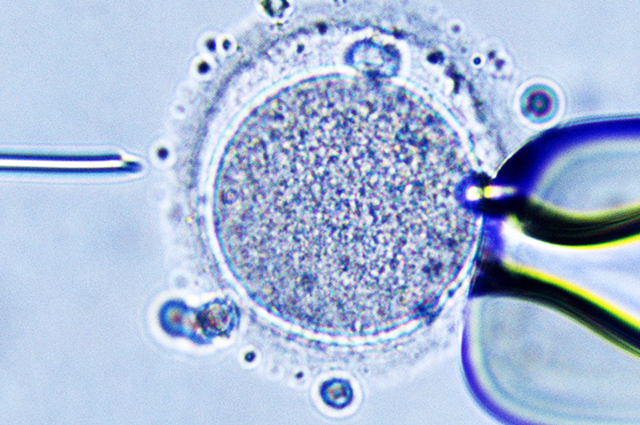 Blastocyst Culture