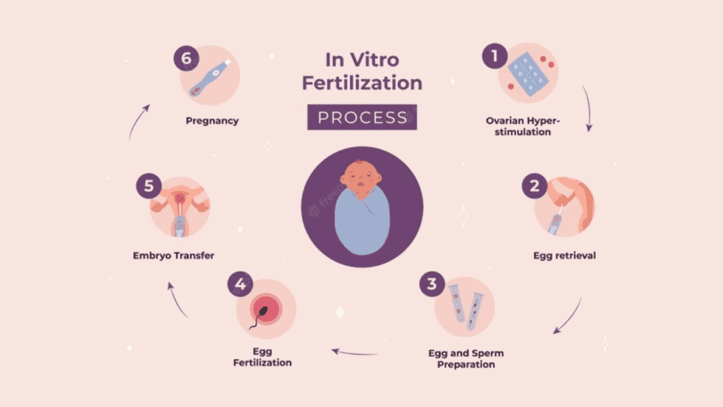 IVF : 6 Things You Should Know Before Starting The IVF Treatment Process