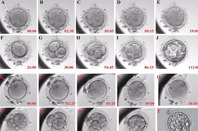 Calcium Ionophore Activation