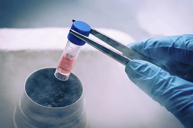 Frozen Embryo Transfer